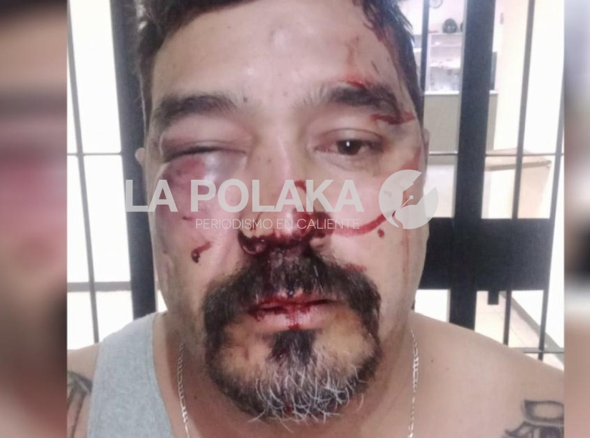 Primates Furiosos Atacan en Parral
