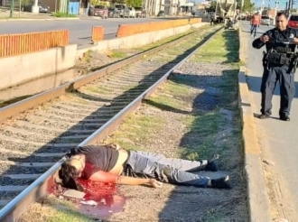 Perdió Con El tren
