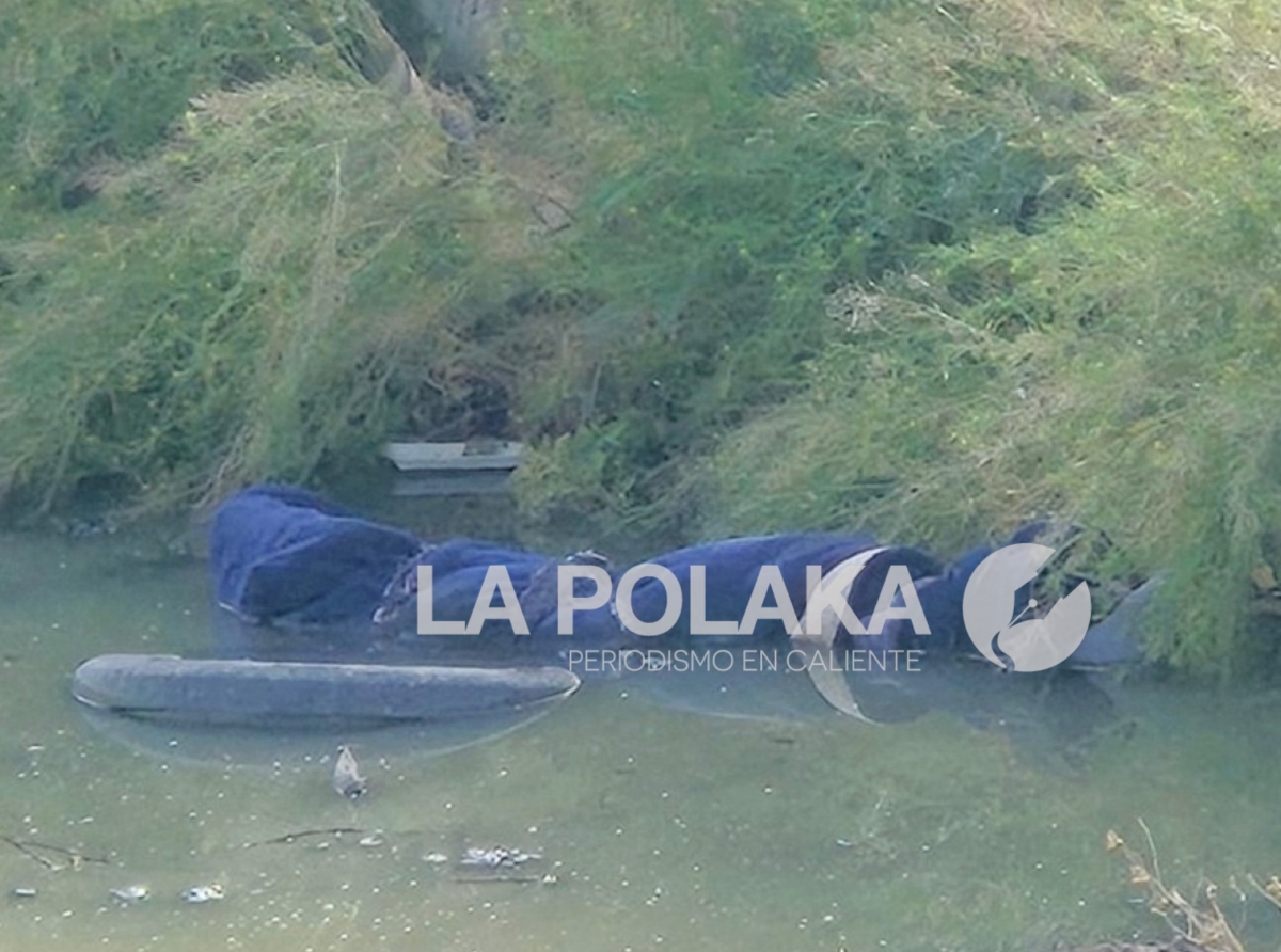 Aparentes Huellas de Violencia