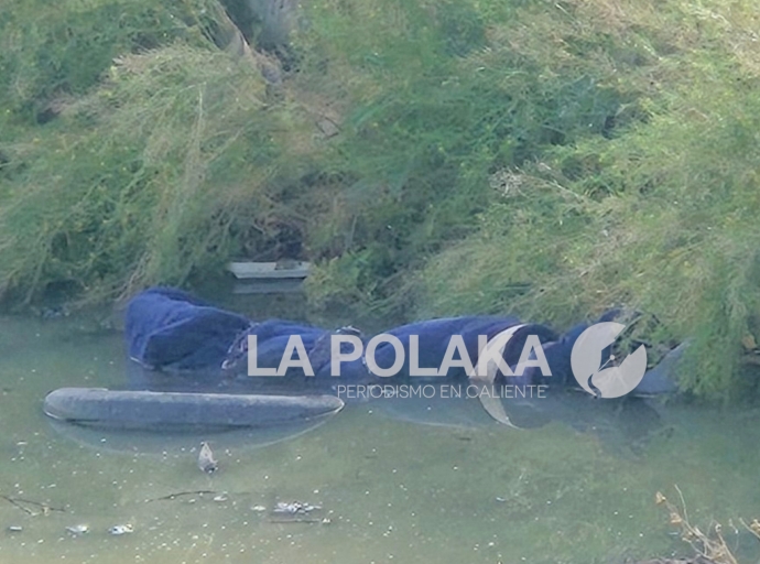 Aparentes Huellas de Violencia